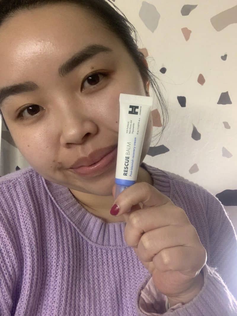 Photo showcasing dry skin around nose and the Hero Cosmetics Rescue Balm